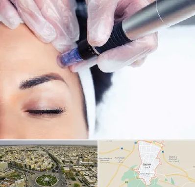 کلینیک مزوتراپی صورت در قزوین