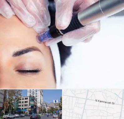 کلینیک مزوتراپی صورت در کامرانیه