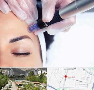 کلینیک مزوتراپی صورت در بلوار تعاون