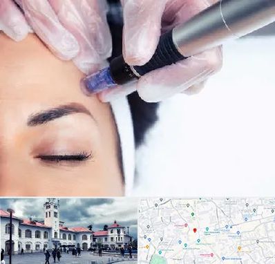 کلینیک مزوتراپی صورت در میدان شهرداری رشت