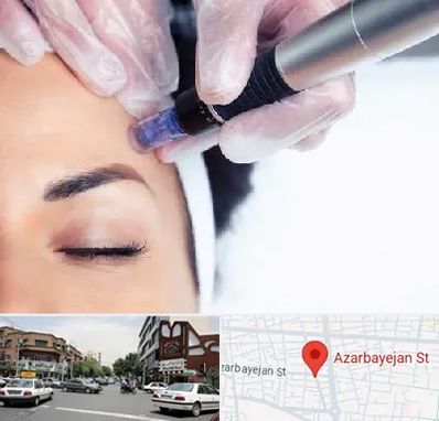 کلینیک مزوتراپی صورت در خیابان آذربایجان