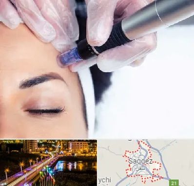 کلینیک مزوتراپی صورت در سقز