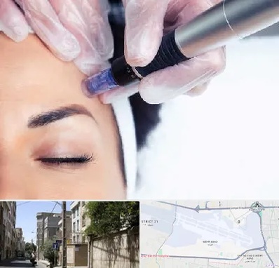 کلینیک مزوتراپی صورت در مهرآباد