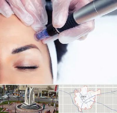 کلینیک مزوتراپی صورت در زابل