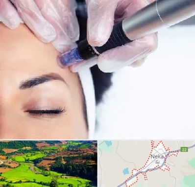 کلینیک مزوتراپی صورت در نکا