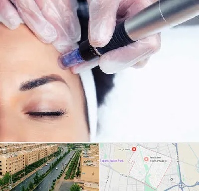 کلینیک مزوتراپی صورت در فاز سه اندیشه