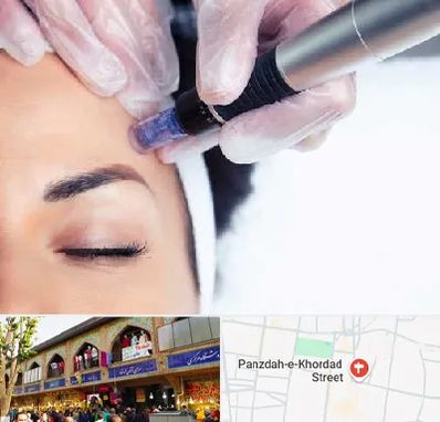 کلینیک مزوتراپی صورت در 15 خرداد