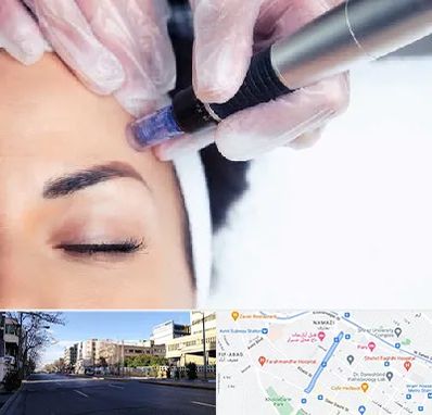 کلینیک مزوتراپی صورت در خیابان ملاصدرا شیراز