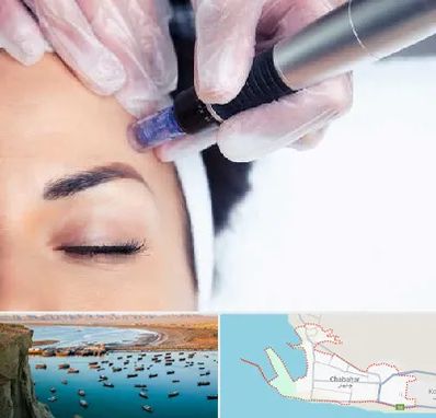 کلینیک مزوتراپی صورت در چابهار