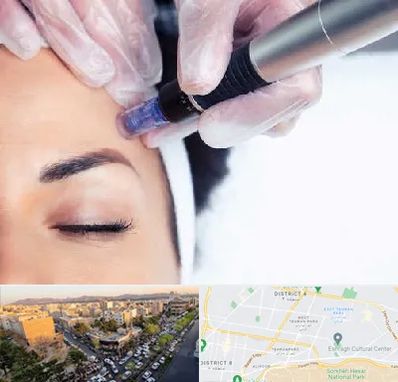 کلینیک مزوتراپی صورت در تهرانپارس 