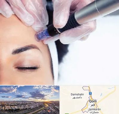 کلینیک مزوتراپی صورت در قم