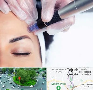 کلینیک مزوتراپی صورت در تجریش 