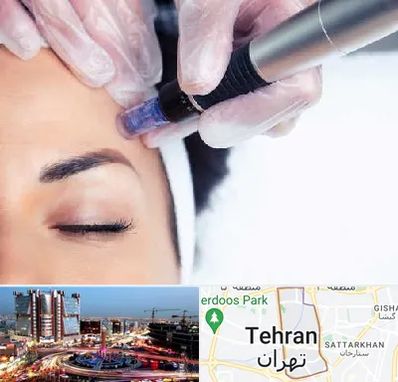 کلینیک مزوتراپی صورت در صادقیه 