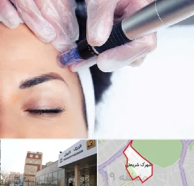 کلینیک مزوتراپی صورت در شهرک شریعتی