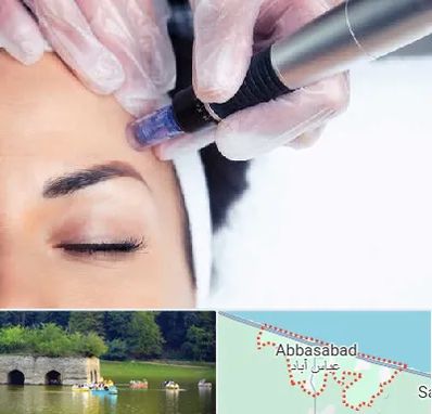 کلینیک مزوتراپی صورت در عباس آباد
