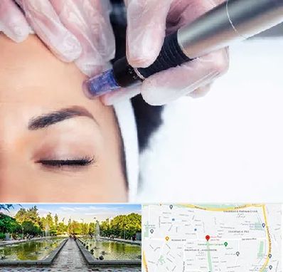 کلینیک مزوتراپی صورت در سرسبز 