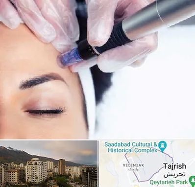 کلینیک مزوتراپی صورت در زعفرانیه 