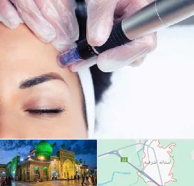 کلینیک مزوتراپی صورت در آستانه اشرفیه