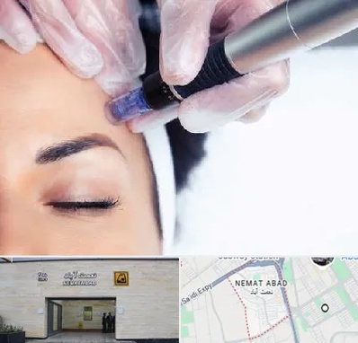 کلینیک مزوتراپی صورت در نعمت آباد