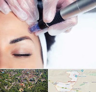 کلینیک مزوتراپی صورت در دماوند