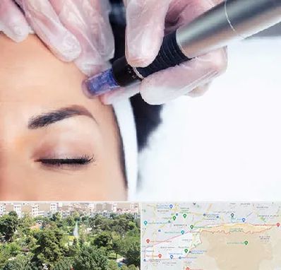 کلینیک مزوتراپی صورت در منطقه 13 تهران 