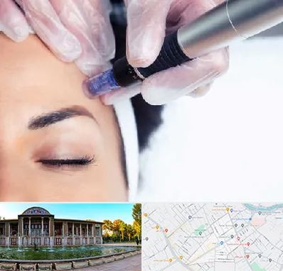 کلینیک مزوتراپی صورت در عفیف آباد شیراز