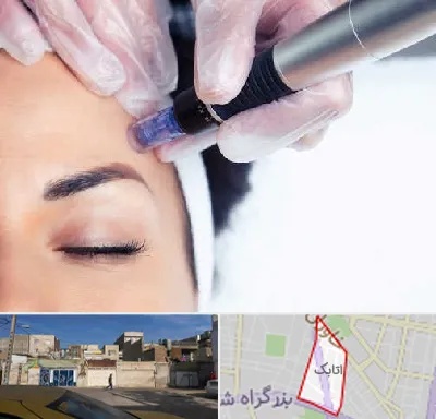 کلینیک مزوتراپی صورت در اتابک