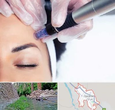 کلینیک مزوتراپی صورت در سراوان