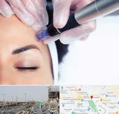 کلینیک مزوتراپی صورت در بلوار توس مشهد