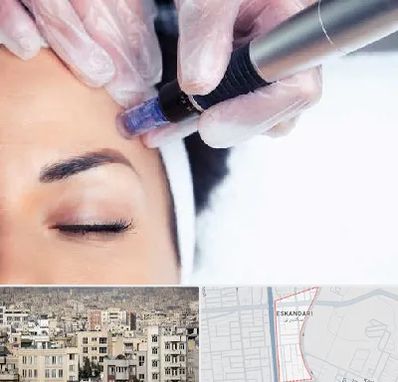 کلینیک مزوتراپی صورت در اسکندری