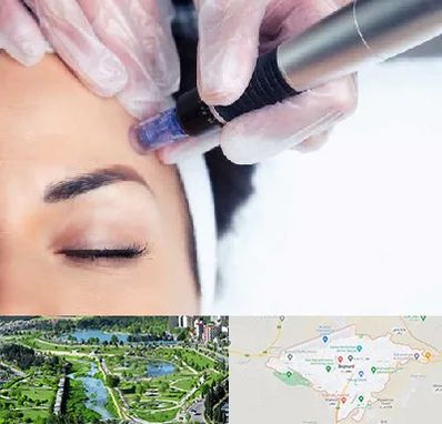 کلینیک مزوتراپی صورت در بجنورد