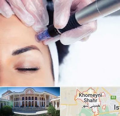 کلینیک مزوتراپی صورت در خمینی شهر