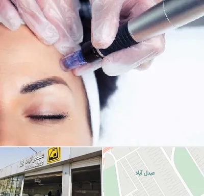 کلینیک مزوتراپی صورت در عبدل آباد