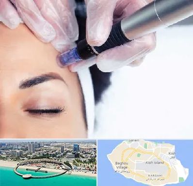 کلینیک مزوتراپی صورت در کیش