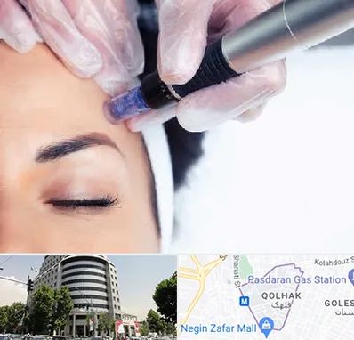 کلینیک مزوتراپی صورت در قلهک 