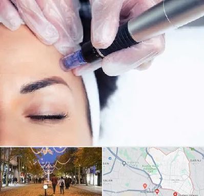 کلینیک مزوتراپی صورت در ولیعصر ارومیه