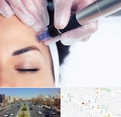 کلینیک مزوتراپی صورت در بلوار معلم مشهد