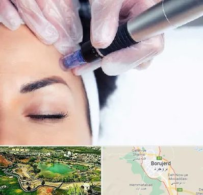 کلینیک مزوتراپی صورت در بروجرد