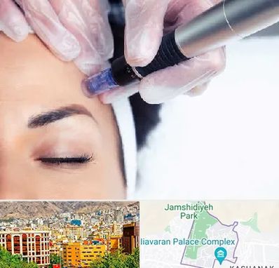 کلینیک مزوتراپی صورت در نیاوران 