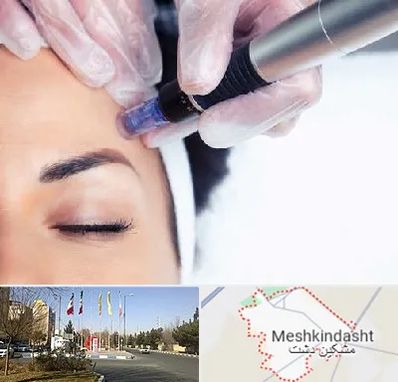 کلینیک مزوتراپی صورت در مشکین دشت