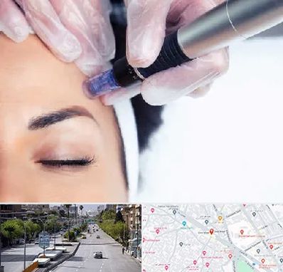 کلینیک مزوتراپی صورت در خیابان زند شیراز