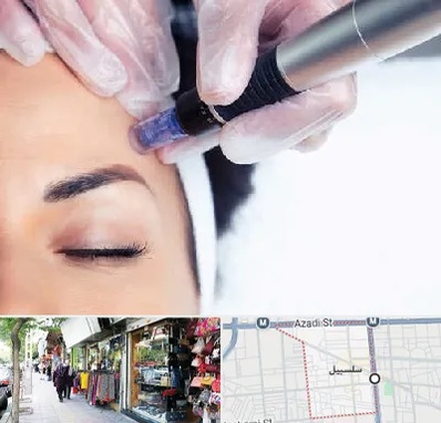 کلینیک مزوتراپی صورت در سلسبیل