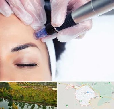 کلینیک مزوتراپی صورت در بهبهان