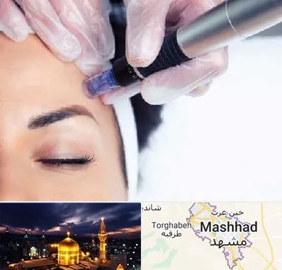 کلینیک مزوتراپی صورت در مشهد