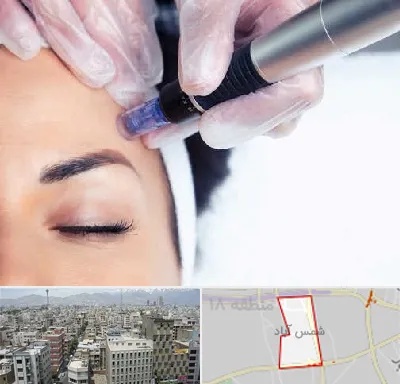 کلینیک مزوتراپی صورت در شمس آباد تهران