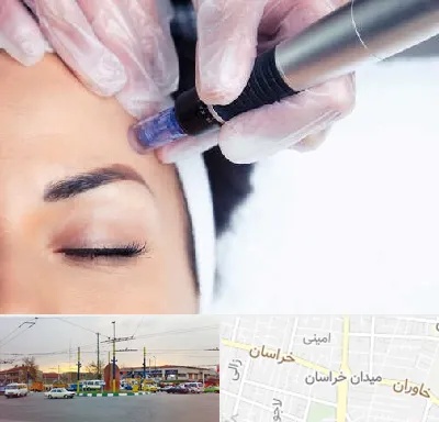 کلینیک مزوتراپی صورت در میدان خراسان