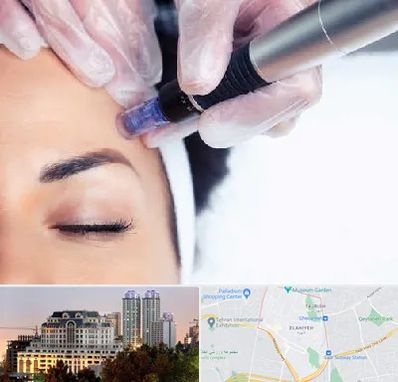 کلینیک مزوتراپی صورت در فرشته 