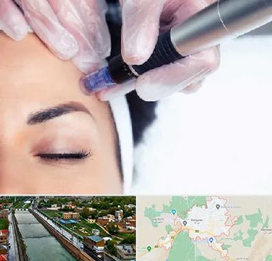 کلینیک مزوتراپی صورت در مراغه