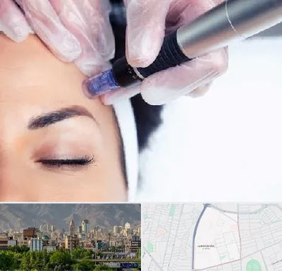 کلینیک مزوتراپی صورت در جمشیدیه