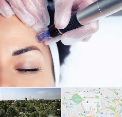 کلینیک مزوتراپی صورت در منطقه 16 تهران 